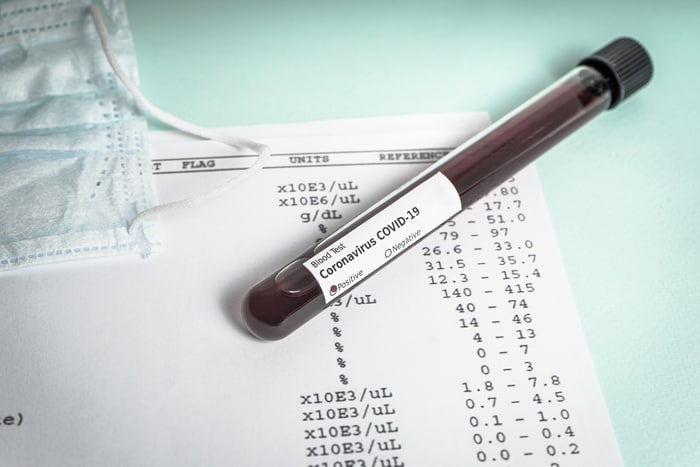 test blood covid 19 in germany
