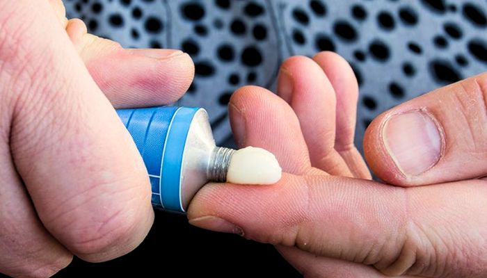  permethrin-cream-on-finger